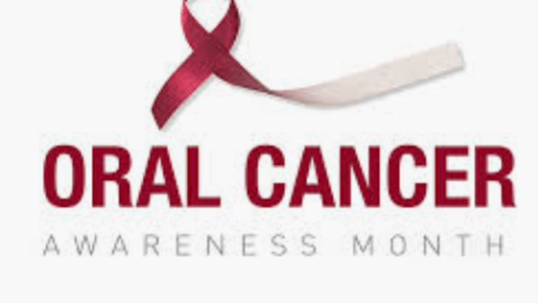 Head and Neck Cancer-What You Need to Know