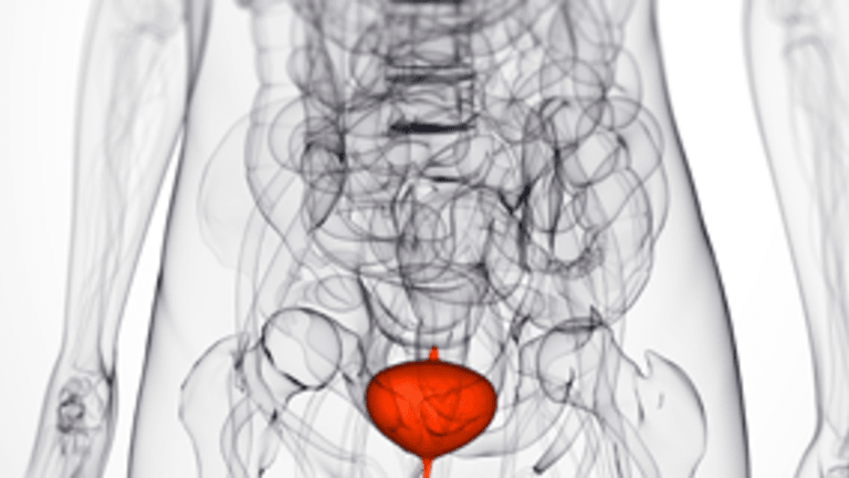 What Every Woman Should Know About Bladder Cancer