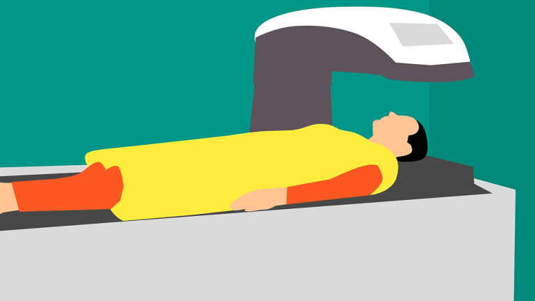 Do I Need a Bone Density Test?