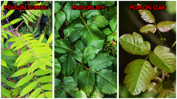 Expert Tips to Ease Itch from Poison Ivy, Oak, and Sumac - A Womans Health